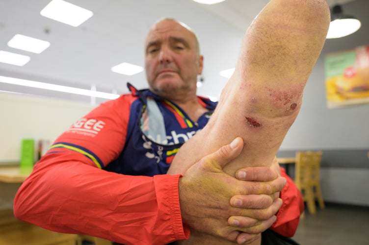 20220728      Copyright image 2022Â©
Lee Spencer showing his injuries after being forced to stop after the wounds on his stump become too deep to enable him to push the pedals after a successful summit of Scafell Pike, Englandâs highest mountain the day before, on his Landâs End to John OâGroats part of his Triathlon of Great Britain today, 28th July 2022. He will be climbing the UKâs three highest peaks - Snowdon, Scafell Pike and Ben Nevis during the ride. Descending from Ben Nevis, Lee will then complete 26 miles before finishing at Spean Bridge. This will be completed within a 14 day period.
Lee Spencer BEM, a veteran amputee who believes that no-one should be defined by their disability, is about to take on another âfirst of a kindâ challenge - the Triathlon of Great Britain. 
To support Lee, please donate at his just giving page - https://www.justgiving.com/fundraising/thetriathlonofgb
Further information is available from Laura Milward on 00350 54003968 / laura@greenroomadvisory.comâ¨Lee is available for interviews (DTBC)
For photographic enquiries please call Anthony Upton 07973 830 517 or email info@anthonyupton.com 
This image is copyright Anthony Upton 2022Â©.
This image has been supplied by Anthony Upton and must be credited Anthony Upton. The author is asserting his full Moral rights in relation to the publication of this image. All rights reserved. Rights for onward transmission of any image or file is not granted or implied. Changing or deleting Copyright information is illegal as specified in the Copyright, Design and Patents Act 1988. If you are in any way unsure of your right to publish this image please contact +447973 830 517 or email: info@anthonyupton.com20220728      Copyright image 2022Â©
 
Apogeeâs support walkers pose during Lee Spencer at the summit of Snowdon ascending, via the Pyg Track and the descent via the Miners Tracker during the Landâs End to John OâGroats part of his Triathlon of Great Britain today, 28th July 