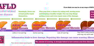 Eighty percent with advanced liver disease in SW are undiagnosed